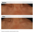 Niacinamide 5% Face and Body Emulsion